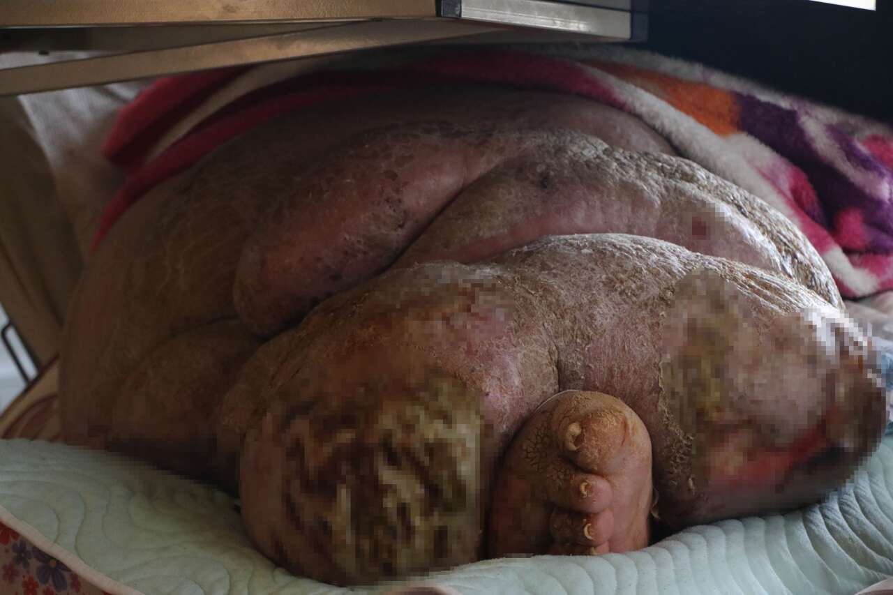 300 kiloluk hayata sıkıştı, 5 yıldır dört duvar arasında 7